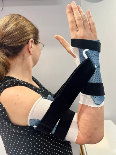 Dynamic-Splint-And-A-Woman