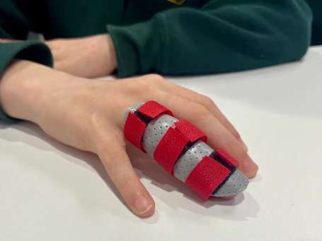 Finger splint for a fracture