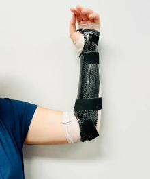 elbow-splinting