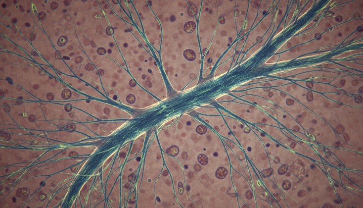 image of nerves
