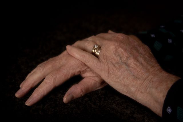 Possible Hand Arthritis