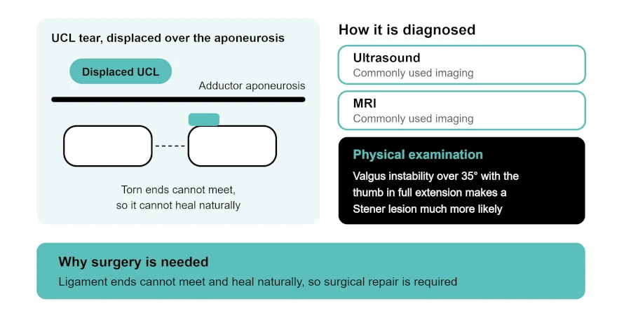 stener_lesion_infog